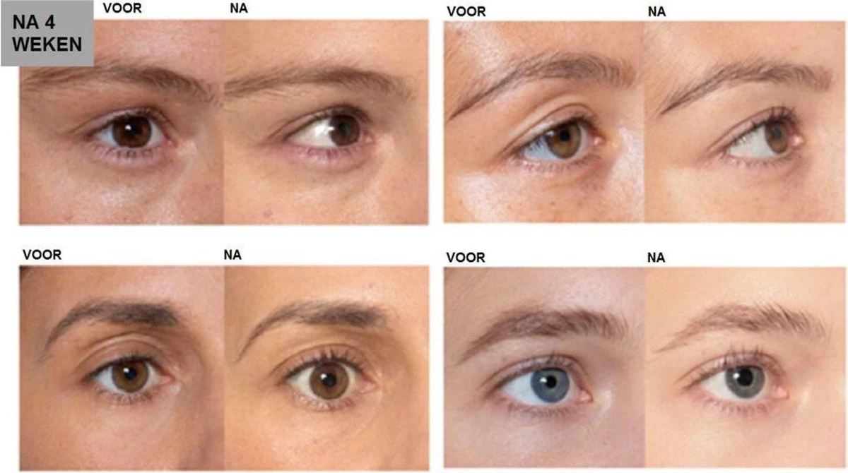 L'Oréal Paris Clinically Proven Wimperserum - 2 Ml 5 L'Oréal Paris Clinically Proven Wimperserum - 2 Ml - Afbeelding 5