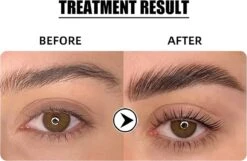 Flora Ruby - Wimper & Wenkbrauw Lifting Set 2 In 1 - Professionele 2 In 1 Lash Lift & Brow Lamination Kit - Permanente Wimperkruller 12 Flora Ruby - Wimper & Wenkbrauw Lifting Set 2 In 1 - Professionele 2 In 1 Lash Lift & Brow Lamination Kit - Permanente Wimperkruller -Cosmetica winkel 1200x782